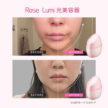 注文コード:05824976 ANLAN Rose Lumi 美顔器 - ANLAN