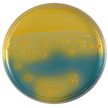 注文コード:62618326,62618335 BD BBL TM BTB乳糖加寒天培地 ベクトン・ディッキンソン