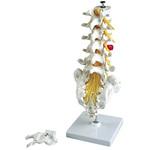 A76/5 腰椎モデルヘルニア付(スタンド付) 京都科学