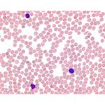 1.01352.0100 メイーグリュンワルドエオシンメチレンブルー 粉末 顕微鏡用 101352 100G Merck(メルクミリポア)