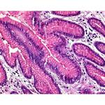 1.04302.0100 ヘマトキシリン 結晶 C.I. 75290 顕微鏡用 104302 100G Merck(メルクミリポア)