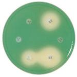 BD BBL TM ミューラーヒントンⅡ寒天培地 ベクトン・ディッキンソン