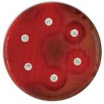 BD BBL TM ミューラーヒントン5%ヒツジ血液寒天培地 ベクトン・ディッキンソン