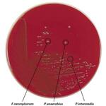 51040 ABHK寒天培地 10枚入 島津ダイアグノスティクス
