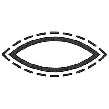 リフラー バローベ