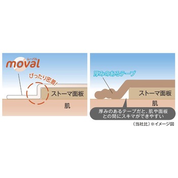 ストーマ面板固定テープ moval(R) 共和(輪ゴム・ゴムバンド)