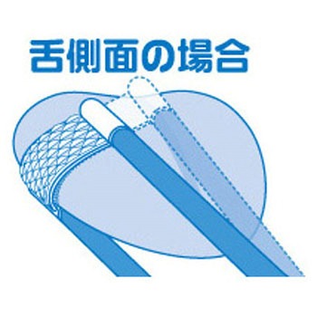 新感覚舌ブラシ したつつみ MMシリーズ 松本金型