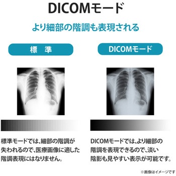「5年保証」3.6MP医用画像参照用27型液晶 I ・O DATA(アイ・オー・データ)