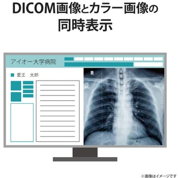 「5年保証」3.6MP医用画像参照用27型液晶 I ・O DATA(アイ・オー・データ)