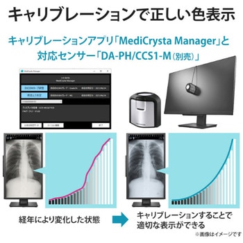 「5年保証」3.6MP医用画像参照用27型液晶 I ・O DATA(アイ・オー・データ)