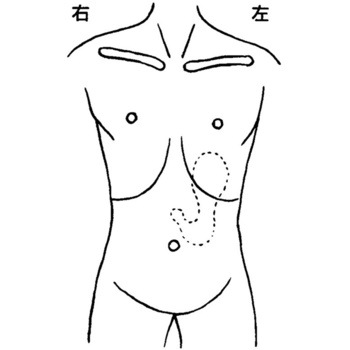 人体図型ゴム印 eastsidemed