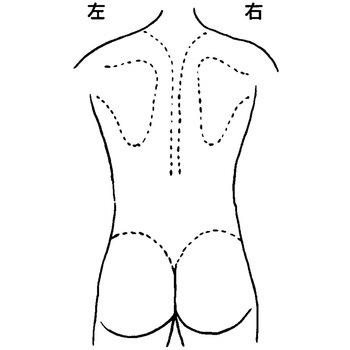 人体図型ゴム印 eastsidemed