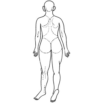 人体図型ゴム印 eastsidemed