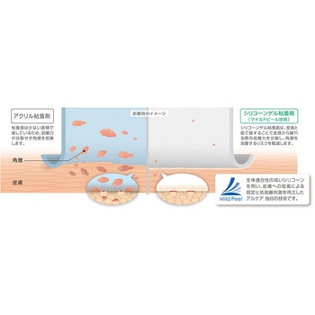 アドプロテープ・クッション アルケア