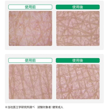 リモイス ラメラ保湿ミルク 保湿性スキンケア乳液 - アルケア