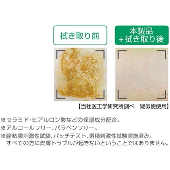 リモイス 泡クレンズ 皮膚清拭・洗浄フォーム アルケア 清拭用品
