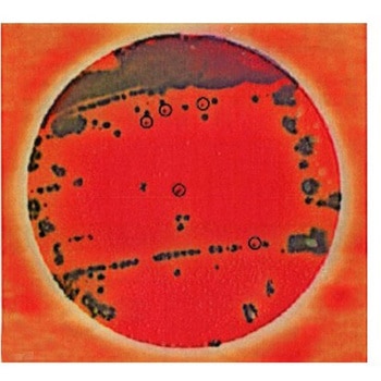 ペトリフィルム(TM)培地(冷蔵) Solventum(ソルベンタム)(旧スリーエム ヘルスケア)