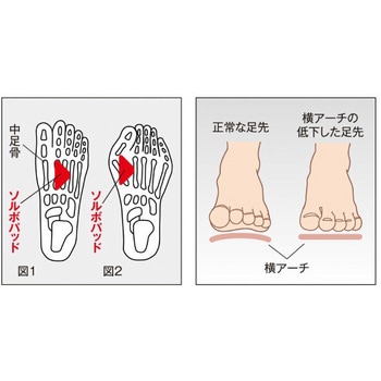 ソルボヨコアーチサポーター 三進興産