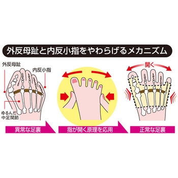 外反母趾・内反小指サポーター アルファックス