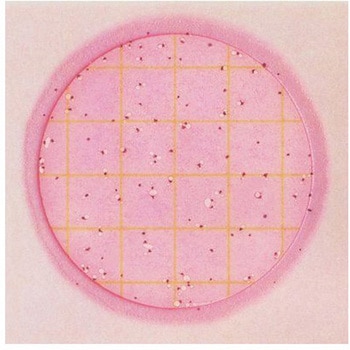 ペトリフィルム(TM)培地(冷蔵) Solventum(ソルベンタム)(旧スリーエム ヘルスケア)