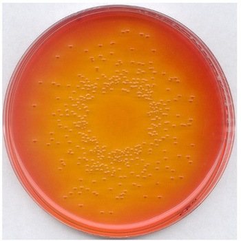 デオキシコール酸乳糖寒天培地 微生物学用 102894 500G Merck(メルクミリポア)