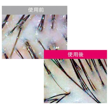 3Dアースシャワーヘッドスパ アラミック