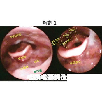 嚥下治療講座 2018山形読影会DVD 甲南医療器研究所