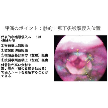 嚥下治療講座 2018山形読影会DVD 甲南医療器研究所
