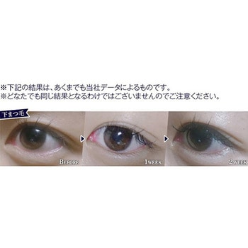 CKL ミラクラッシュジェルEX 3mL CML
