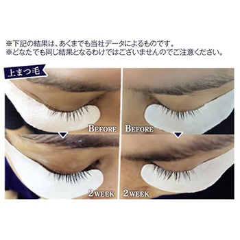 CKL ミラクラッシュジェルEX 3mL CML