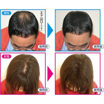 ティップトップ 詰め替え用20g ウィングエンタープライズ