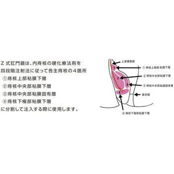 Z式肛門鏡 D型 - 荒川製作所