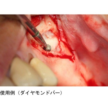 HO グラフトバーキット マイクロテック