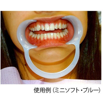 開口器 オーラルワイダー ザイコア・インターナショナル・インク