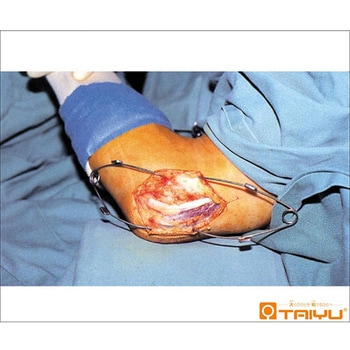 小谷式皮膚開創鈎 TY-6890シリーズ TAIYU(大祐医科工業)