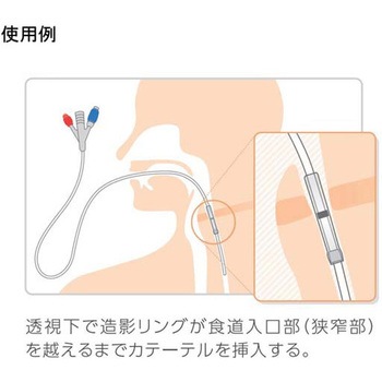 食道拡張用バルーンカテーテル 2本入 - クリエートメディック
