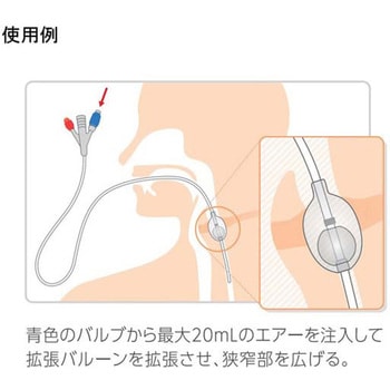 食道拡張用バルーンカテーテル 2本入 - クリエートメディック