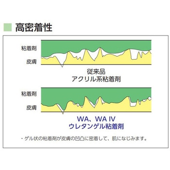 サージット(R)10 WA IV NSD10 NIPRO(ニプロ)