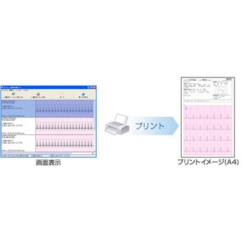 心電計 心電図印刷ソフト オムロンヘルスケア