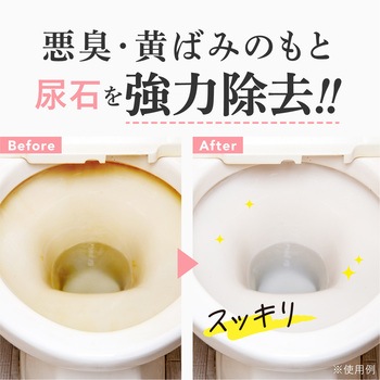 GEL PiKA 尿石取りジェル チューブタイプ アルファックス