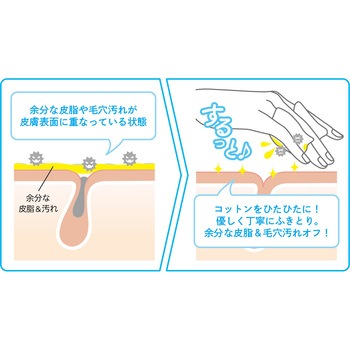 アキュネ 薬用ふきとりローションT アロインス化粧品