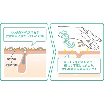 アキュネ 薬用ふきとりローションU アロインス化粧品