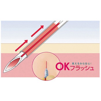 サーフローF&F 静脈留置針 SR-FFシリーズ TERMO(テルモ)