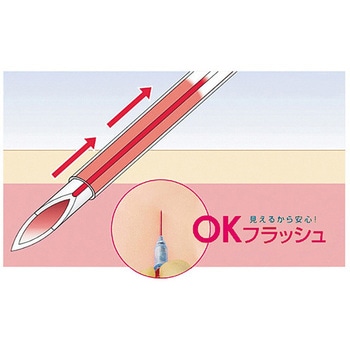 サーフローフラッシュ 静脈留置針 SR-FSシリーズ TERMO(テルモ)
