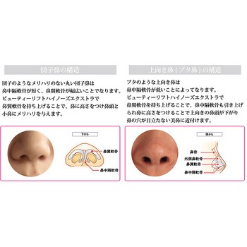オムニ ビューティーリフトハイノーズエクストラ 鼻専用美容器 鼻矯正 痛くない OMNI
