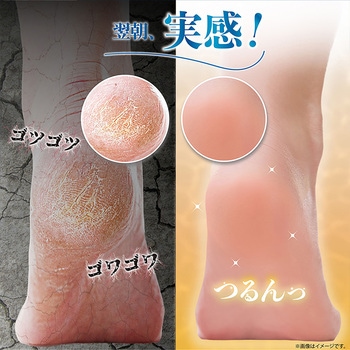 空気が通るつるピカソックス カサカサ底マメ対策 ムレにくい 男女兼用 アクセス