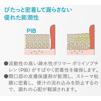 センシュラ1 イレオ Xpro プラス 観察窓付 肌色 コロプラスト