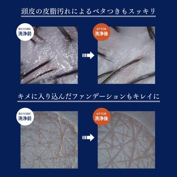 ナノバブルシャワー BIRAKU YAMAZEN(山善)