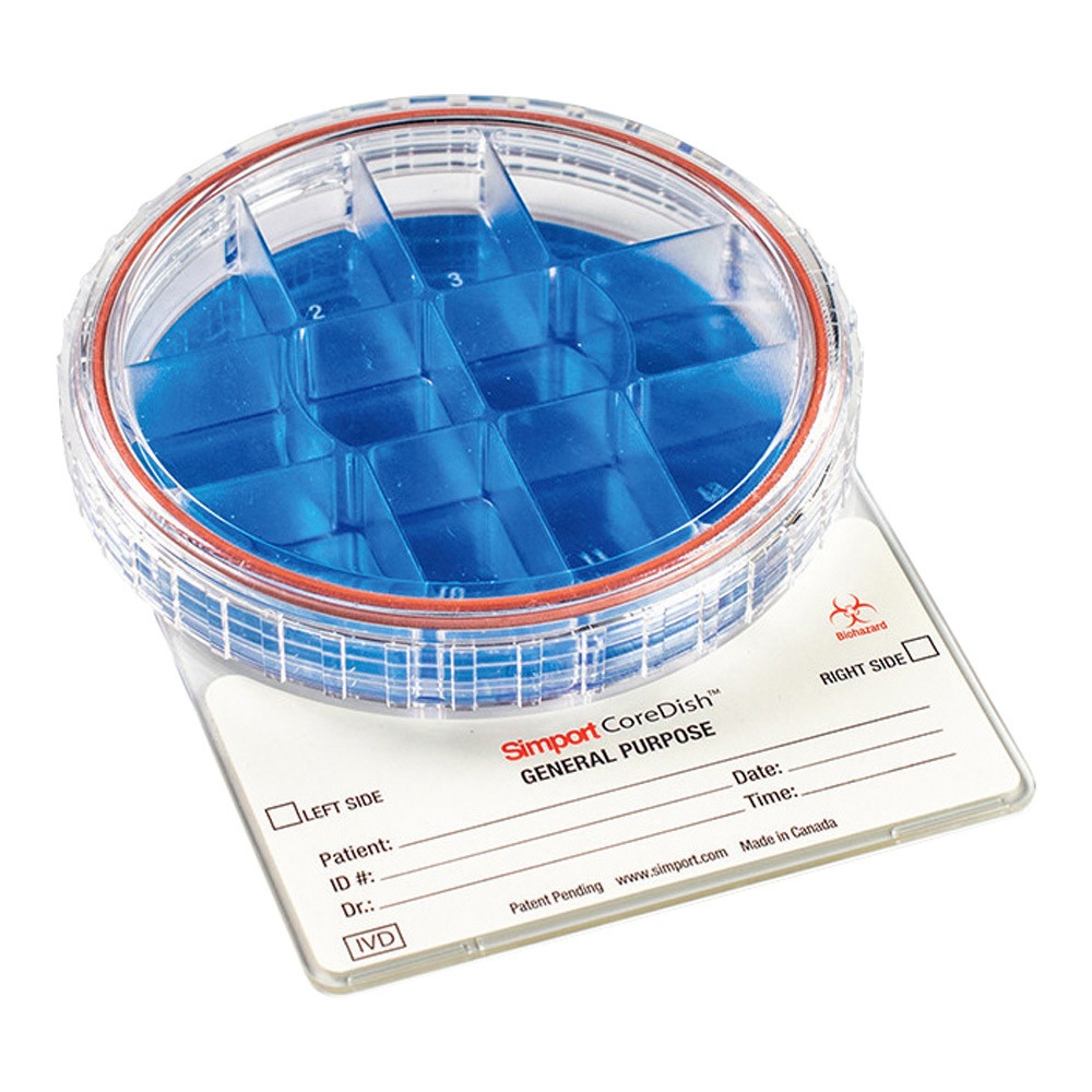 M971-D12 生理検体保管容器 COREDISH(R) ノーマル 1ケース 10個入 M971-Dシリーズ 1ケース(10個) アズワン 【通販モノタロウ】 12,243円