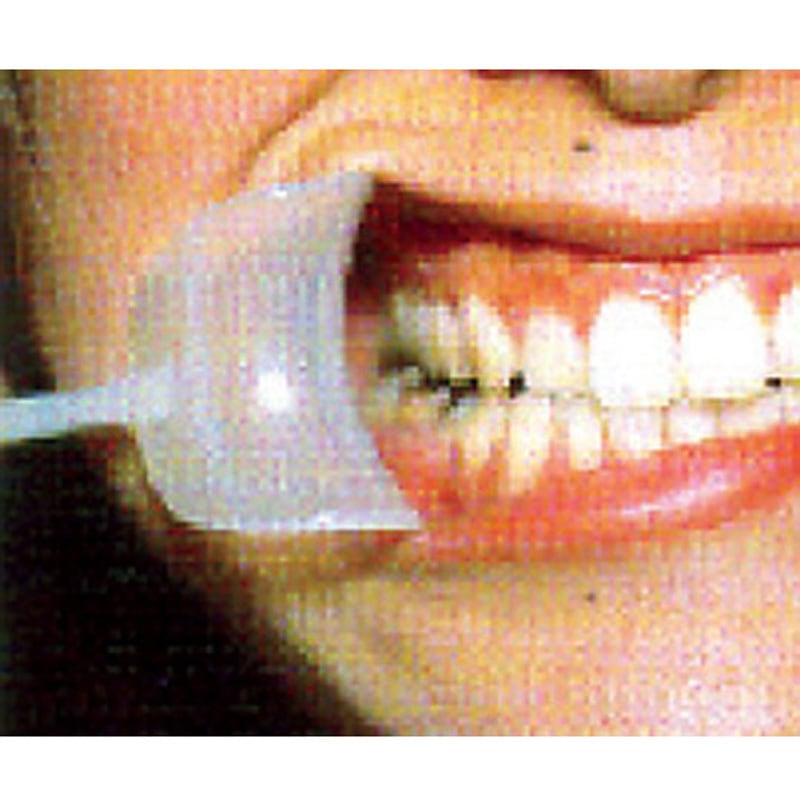 5119 唇開口器 1個 斉藤工業 【通販モノタロウ】